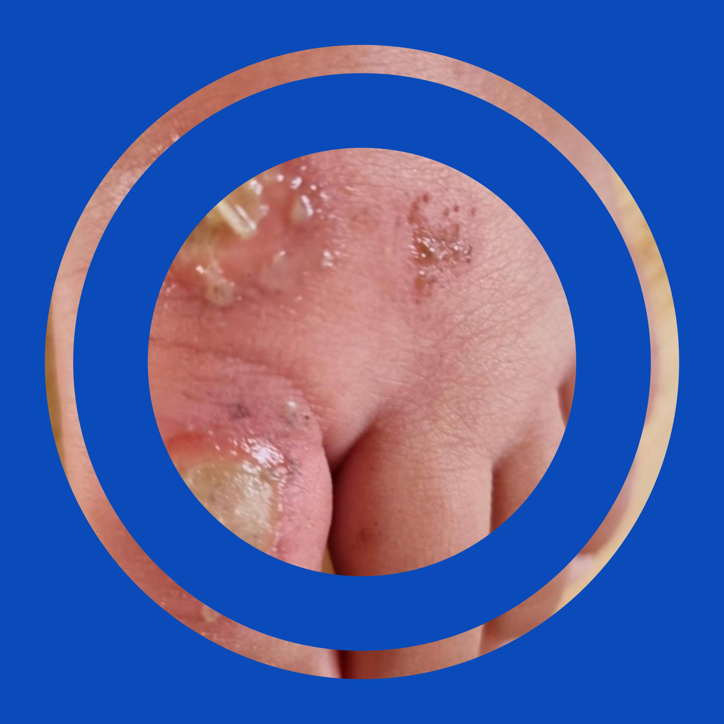 Aflevering 30 - Krentenbaard